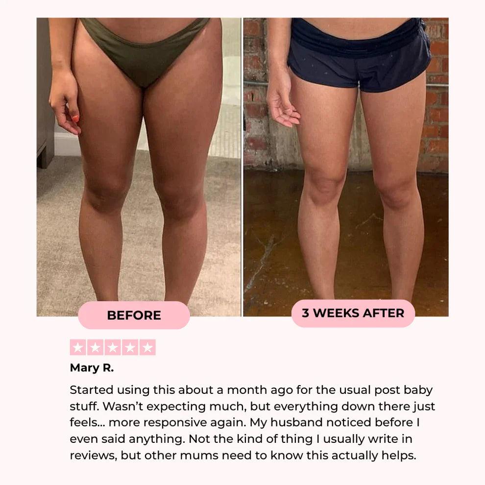 Kallisti Thigh & Pelvic Trainer