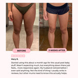 Kallisti Thigh & Pelvic Trainer
