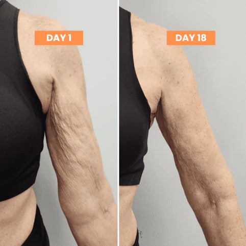 Thermotone Arm Sleeve 2